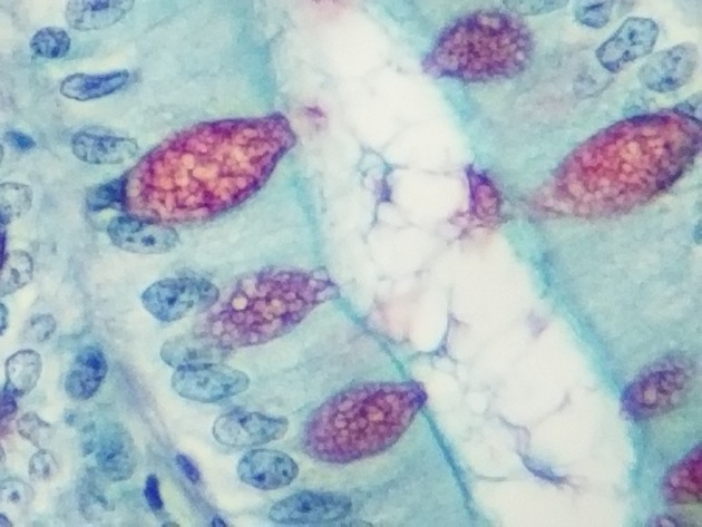 Simple Columnar Epithelium Slides - Simple Columnar Epithelium 20 400X